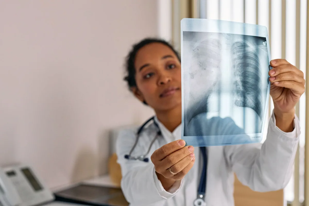 Ortopedista analisando radiografia do ombro para planejar uma artroplastia
